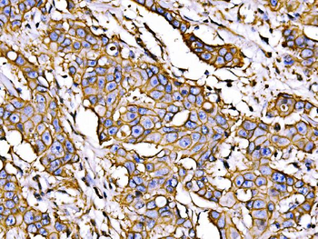 ATP1B1 Antibody