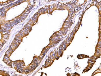 ATP1B1 Antibody