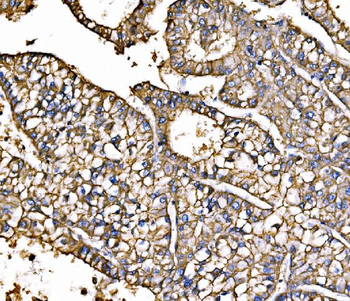 ATP1B1 Antibody