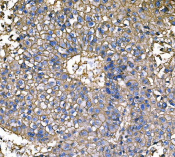 ATP1B1 Antibody