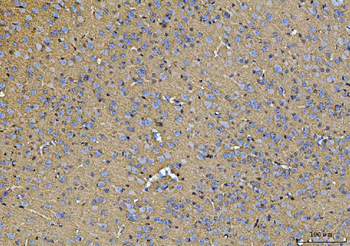 ATP1B1 Antibody