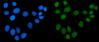 ACF1/BAZ1A Rabbit Polyclonal Antibody