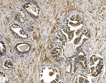 BCKDHA Antibody