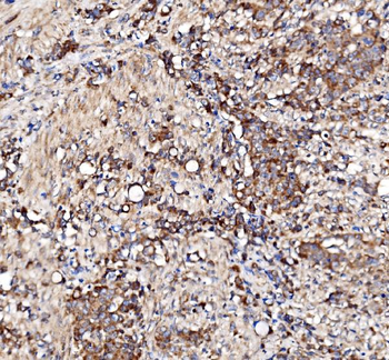 BCKDHA Antibody