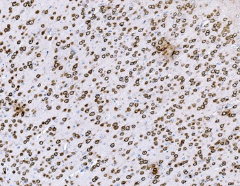 BCKDHA Antibody