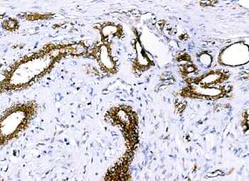 BCKDHA Antibody