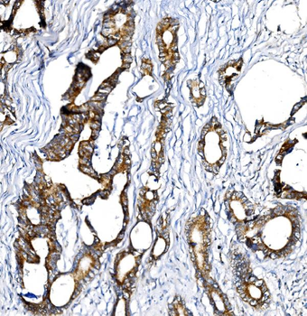 BCKDHA Antibody