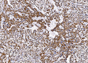 BCKDHA Antibody