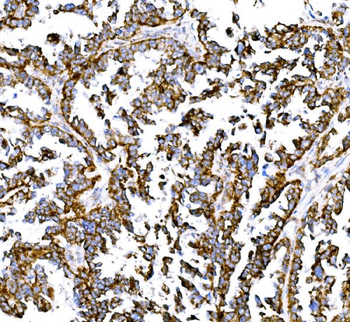 BCKDHA Antibody