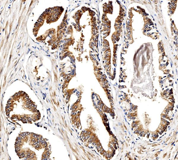 BCKDHA Antibody