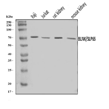 BLNK Rabbit Polyclonal Antibody