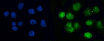 BRCC36/BRCC3 Antibody