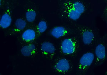 BRSK1 Rabbit Polyclonal Antibody