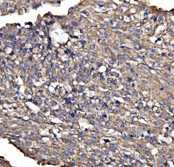 BRSK1 Rabbit Polyclonal Antibody