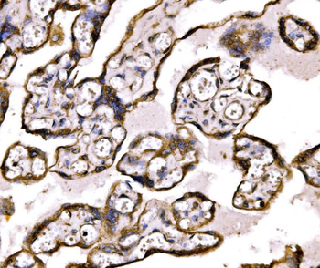 BRSK1 Rabbit Polyclonal Antibody