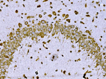 BRSK1 Rabbit Polyclonal Antibody