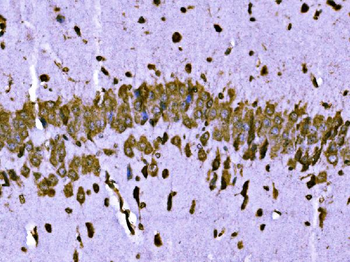 BRSK1 Rabbit Polyclonal Antibody