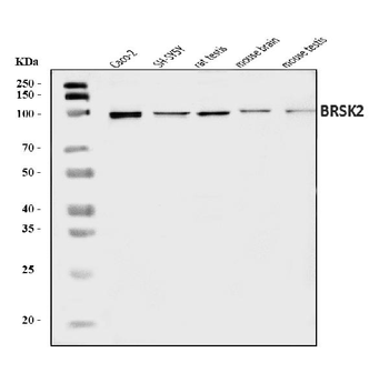 BRSK2 Rabbit Polyclonal Antibody