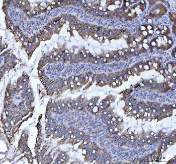 LI Cadherin/CDH17 Antibody