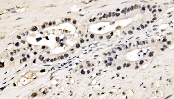 CPSF6 Antibody