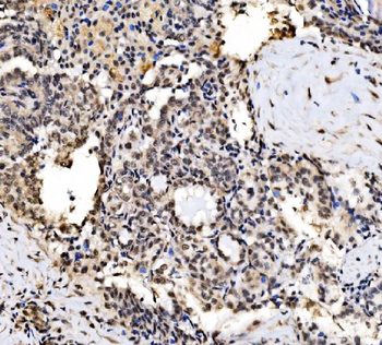CPSF6 Antibody