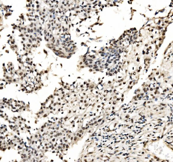 CPSF6 Antibody