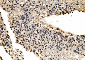 CPSF6 Antibody
