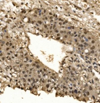 CPSF6 Antibody