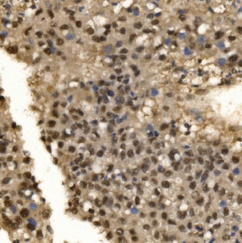 CPSF6 Antibody