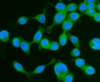 Drebrin/DBN1 Antibody