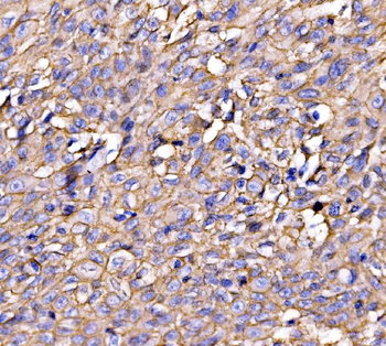 Drebrin/DBN1 Antibody