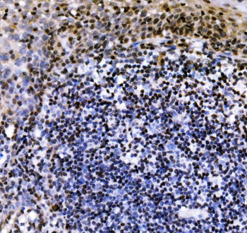 VPRBP/DCAF1 Antibody