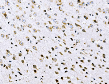 VPRBP/DCAF1 Antibody
