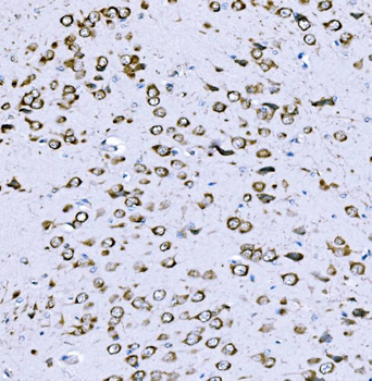 VPRBP/DCAF1 Antibody