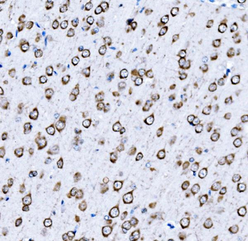 VPRBP/DCAF1 Antibody
