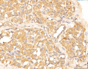EIF4B Rabbit Polyclonal Antibody