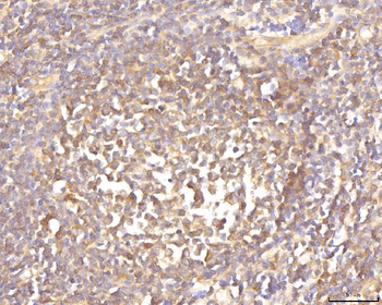 EIF4B Rabbit Polyclonal Antibody