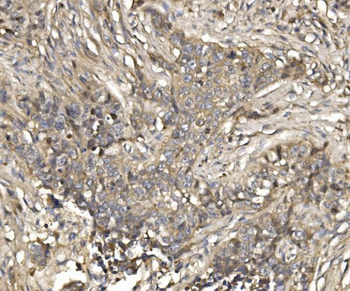 EIF4EBP1 Antibody