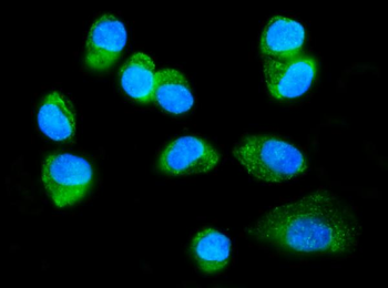 FXR1 Rabbit Polyclonal Antibody