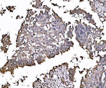 FXR1 Rabbit Polyclonal Antibody