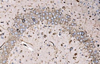 FXR1 Rabbit Polyclonal Antibody