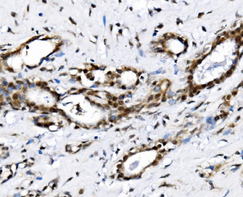 NOLA1/GAR1 Antibody