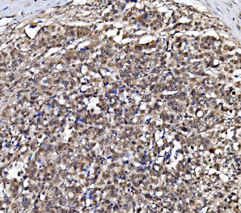 NOLA1/GAR1 Antibody