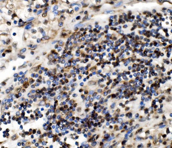 NOLA1/GAR1 Antibody