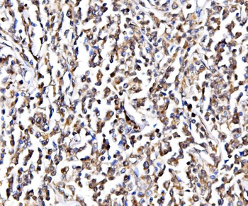 NOLA1/GAR1 Antibody