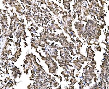 NOLA1/GAR1 Antibody