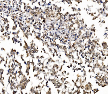 NOLA1/GAR1 Antibody