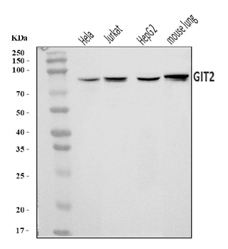 GIT2 Rabbit Polyclonal Antibody
