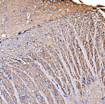 GNAL Rabbit Polyclonal Antibody