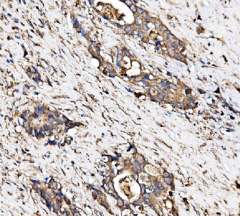 PIST/GOPC Rabbit Polyclonal Antibody